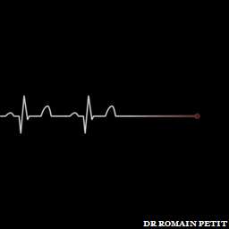 Illustration de la référence Poster ANGELS - Electrocardiogramme 